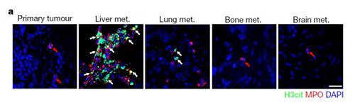转入小鼠模子获得相同的试验效果，且在转移爆发前NET已在肝脏聚积。