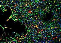 天下首创：药物将干细胞指导至受损部位，提高其愈合能力！