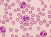 一种神秘颗粒被发明了！它能否成为败血症早筛标记物？