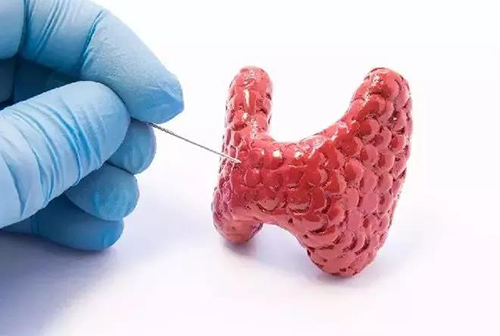 甲状腺疾病，包括甲状腺功效减退和甲状腺功效亢进，自古以来就是重复被医学研究职员研究的疾病