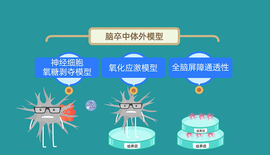 缺血性脑卒中体内的脑缺血模子研究模子