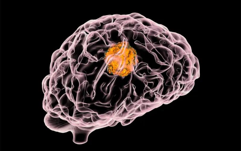 尊龙凯时助力 | 璧辰医药ABM-1310获美国FDA孤儿药资格认证，用于治疗携带BRAF V600突变的脑胶质母细胞瘤患者